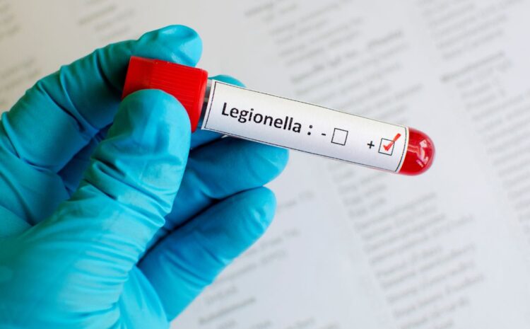 Il Rischio Legionella